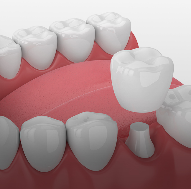 Treatment - 23 Dental