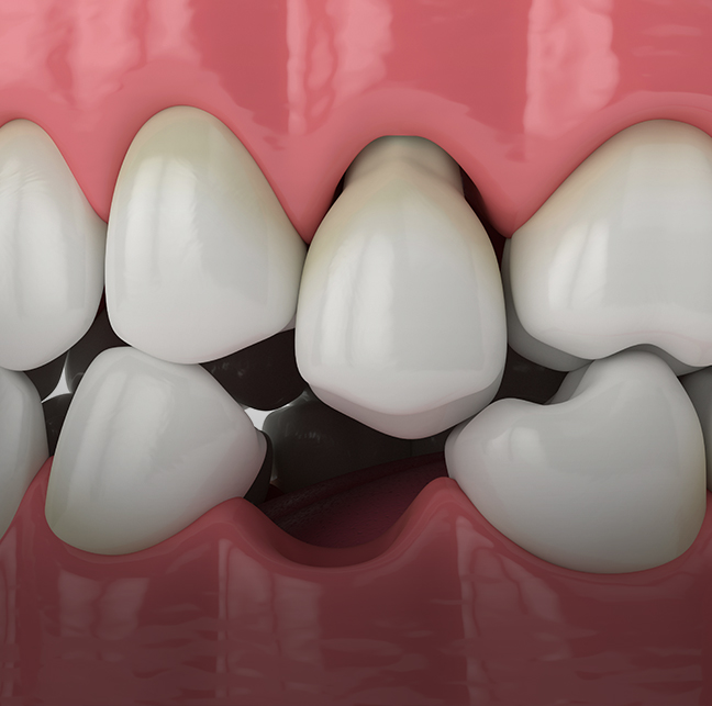 Treatment - 23 Dental