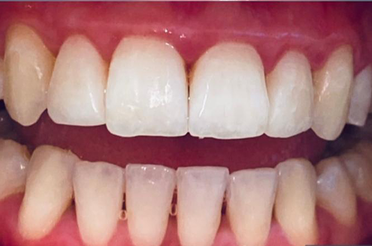 After -23 Dental