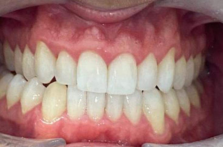 After -23 Dental
